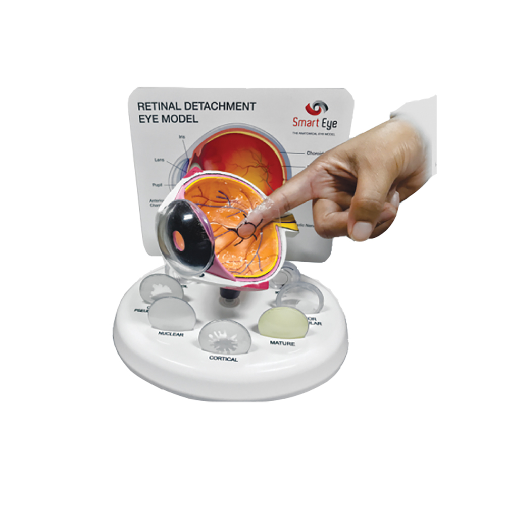Eye Models - Retinal Detachment