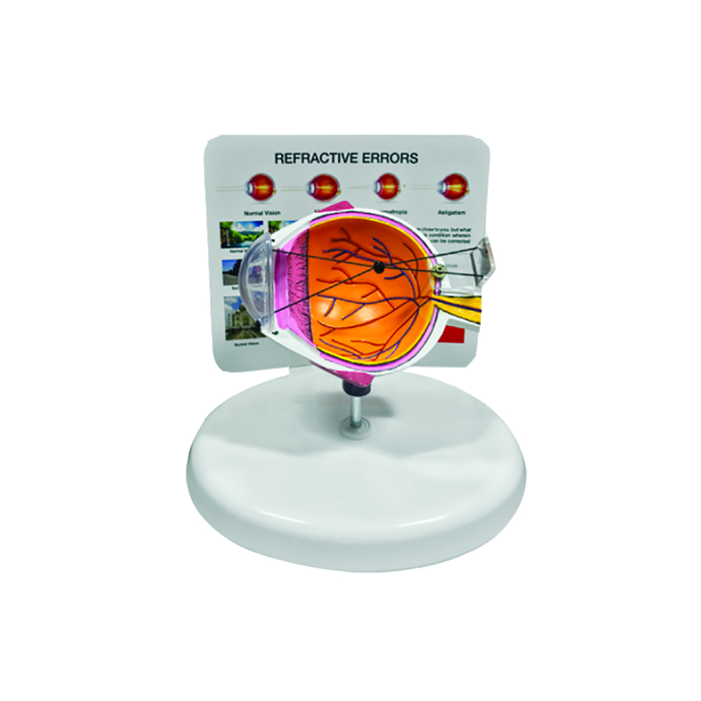 Eye Models - Refractive Errors