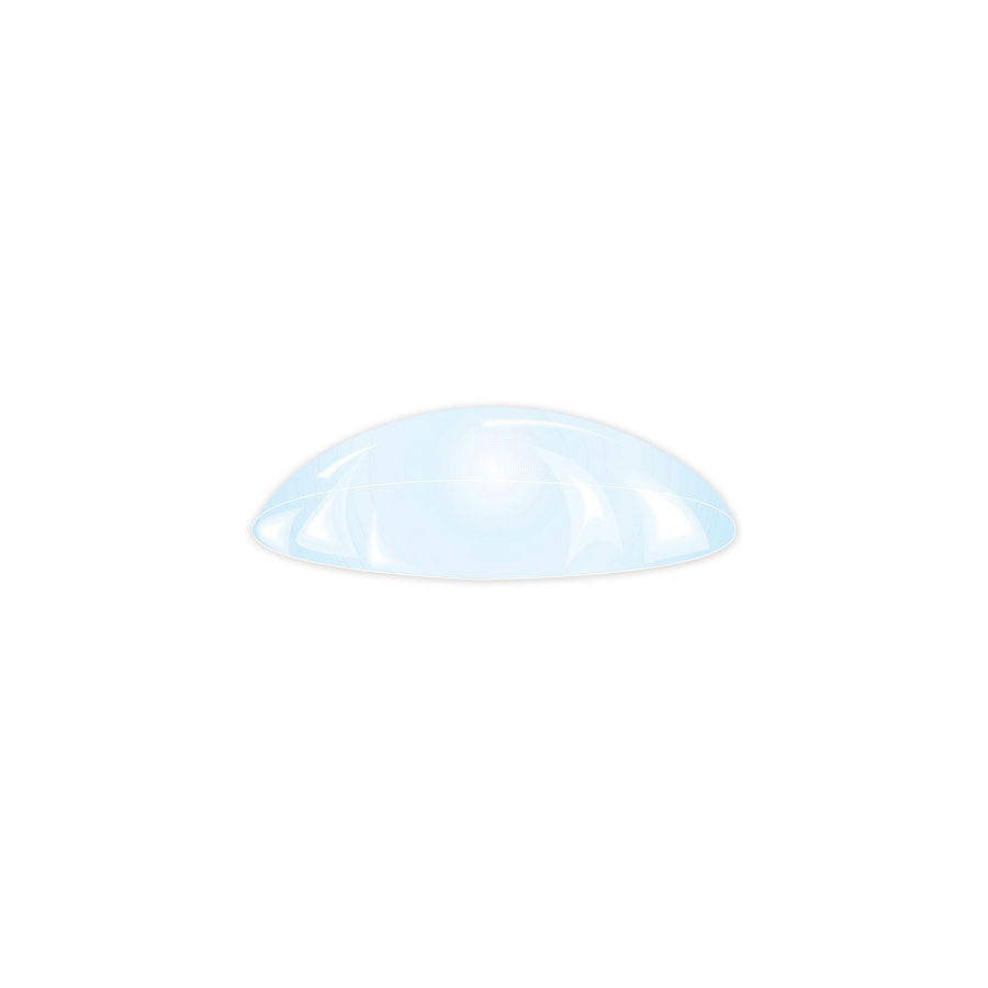 Bandage Lenses for Post Sclerostomy