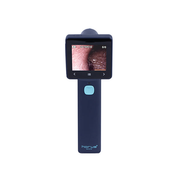 EZ-Horus OTO Blue Digital Otoscope