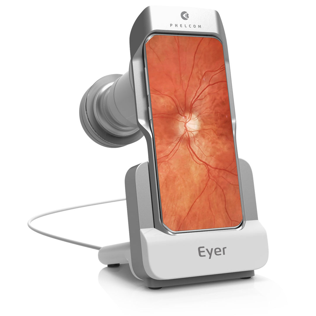 EYER M-STD Retinal Camera